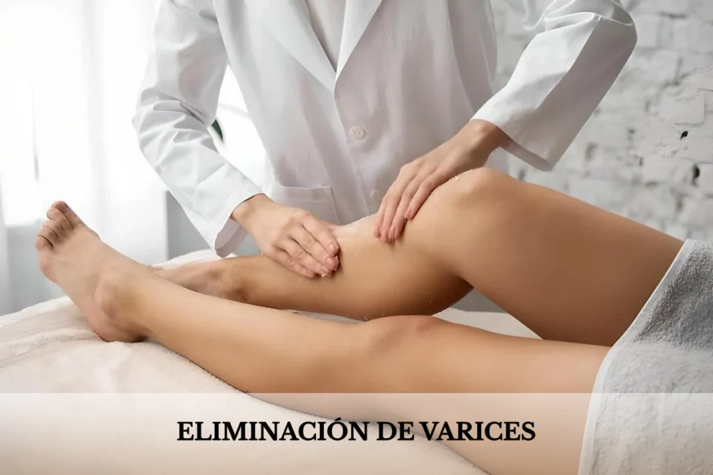 sesion eliminacion de varices