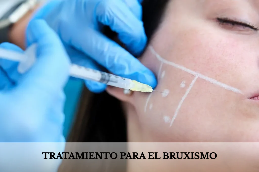 terapia para el bruxismo con botox