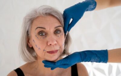 Hilos Tensores Faciales: Un Enfoque Innovador para la Rejuvenecimiento Facial