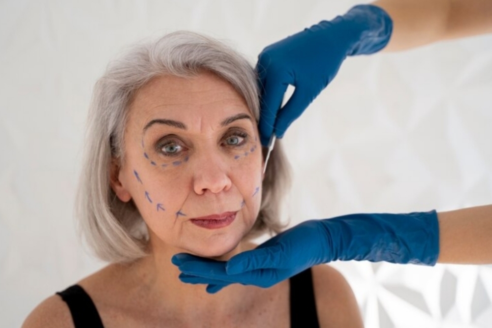 mujer mayor con marca de delineado facial recibiendo evaluacion para tratamiento estetico