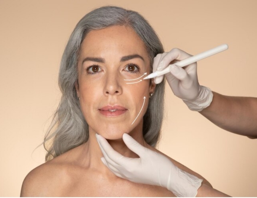 mujer mayor recibiendo inyeccion estetica en la cara con guantes blancos en ambiente clinico