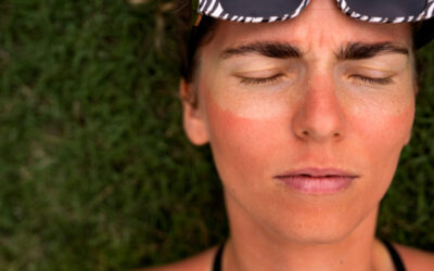Cómo eliminar las manchas solares en otoño: los tratamientos más efectivos en medicina estética