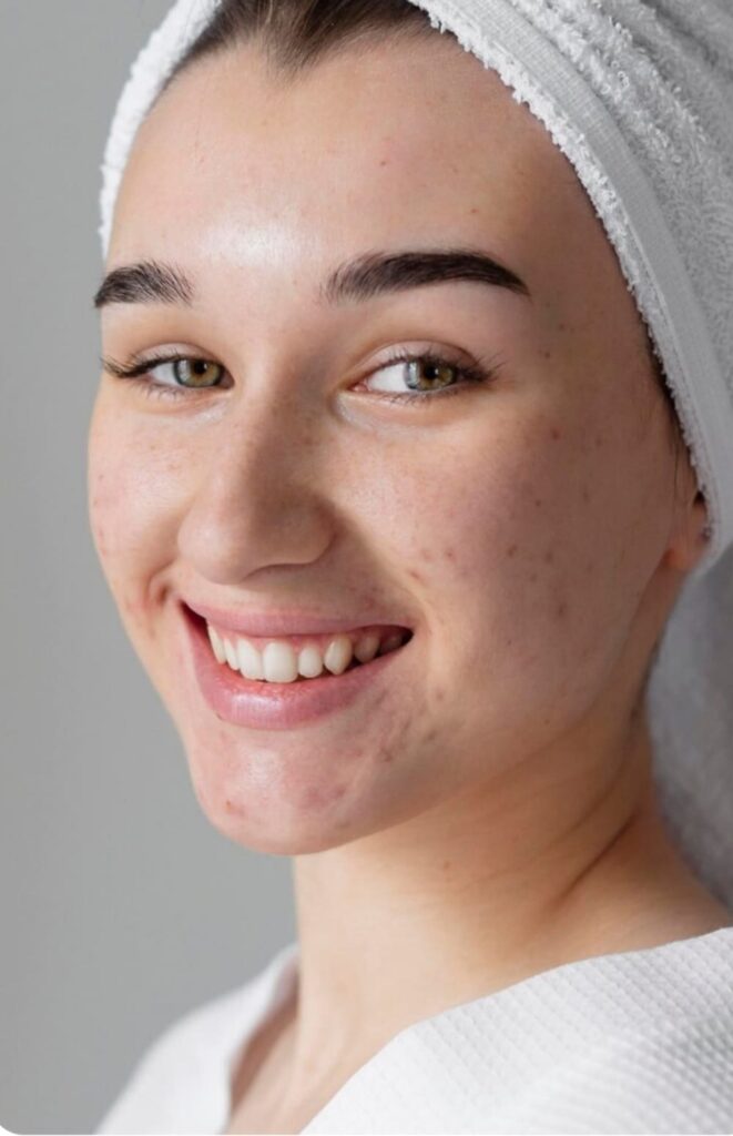 clinica mawa majadahonda cuidado facial mujer joven piel sana