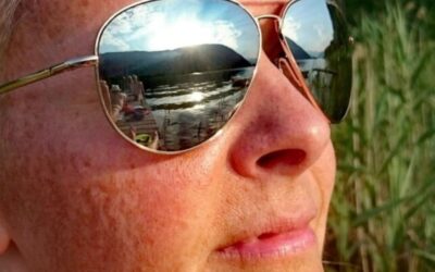 Cómo eliminar manchas y acné con tratamientos médico-estéticos en MAWA Majadahonda