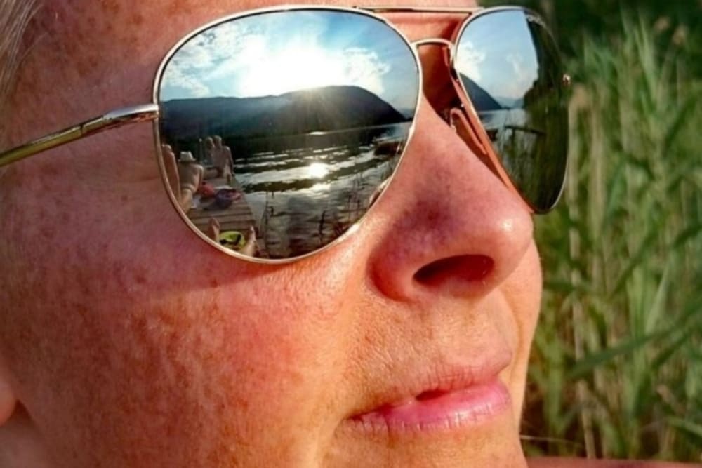 majadahonda clinica mawa proteccion solar mujer madura cuidados piel