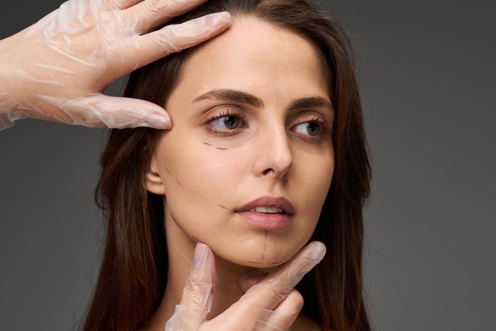 mini lifting majadahonda hilos tensores ovalo facial clinica mawa
