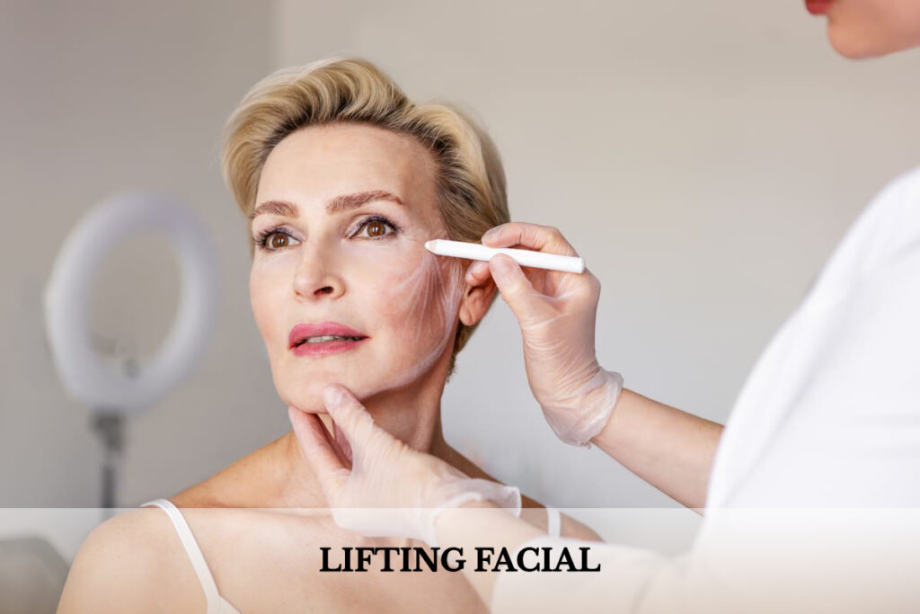 tratamiento lifting facial hilos tensores ovalo facial tratamiento lifting facial hilos tensores ovalo facial